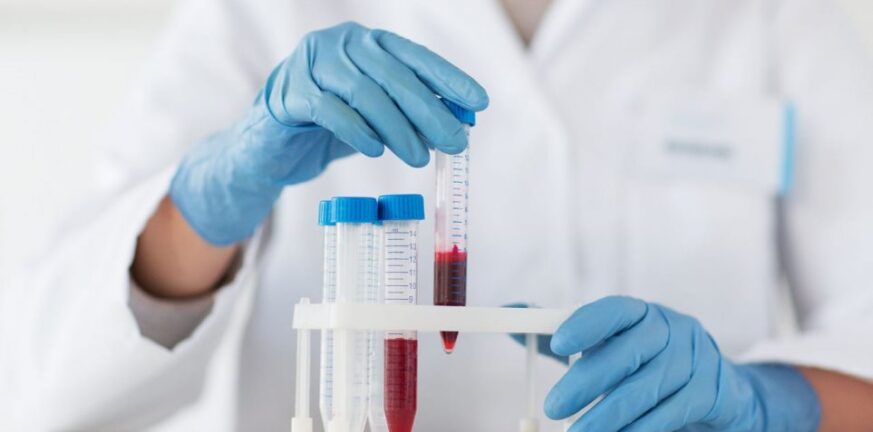 Κορονοϊός: Νέο τεστ αίματος αυτο-αντισωμάτων «βλέπει» την πιθανότητα σοβαρής νόσησης