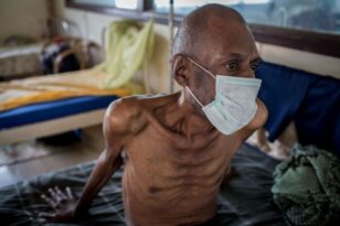 ΠΟΥ: Συναγερμός για την αύξηση των θανάτων από φυματίωση