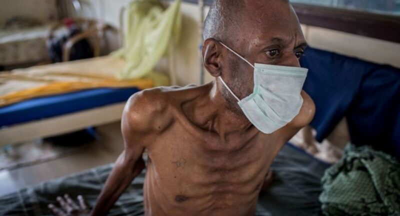 ΠΟΥ: Συναγερμός για την αύξηση των θανάτων από φυματίωση
