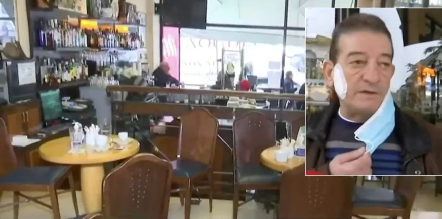 Νάουσα: Άνδρας δάγκωσε ιδιοκτήτη καφέ στο μάγουλο γιατί τού ζήτησε το πιστοποιητικό εμβολιασμού-ΒΙΝΤΕΟ