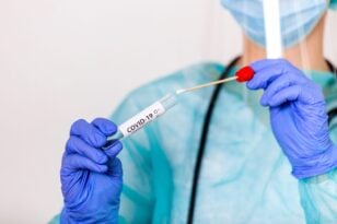 Κορονοϊός: Αύξηση 161% στα PCR τεστ την τελευταία εβδομάδα του Δεκεμβρίου