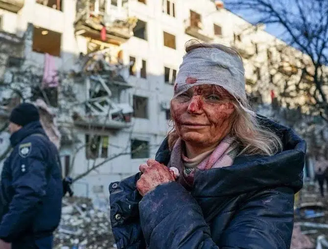 Ουκρανία: H φωτογραφία με την τραυματισμένη γυναίκα που συγκλονίζει τον πλανήτη