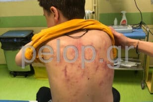 ΑΠΟΚΛΕΙΣΤΙΚΟ - Πάτρα: Καταδίκη μαθητών για ξυλοδαρμό ΑΜΕΑ - Επιχειρήθηκε αποσιώπηση του θέματος