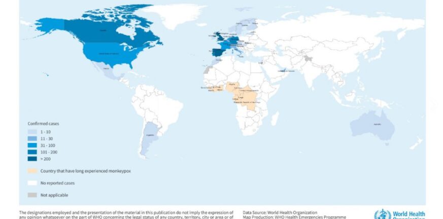 Ευλογιά των πιθήκων: Πάνω από 1.200 κρούσματα σε 28 χώρες – Τι πρέπει να προσέχουν οι ταξιδιώτες
