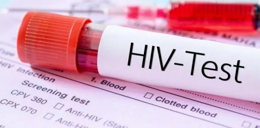 AIDS: Θεραπεύτηκε από τον ιό HIV ο γηραιότερος ασθενής