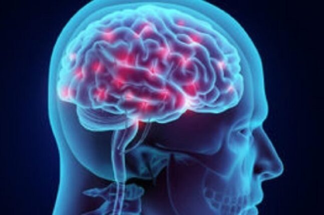 Νευροεπιστήμη: Ανακαλύφθηκαν ειδικοί νευρώνες του φαγητού στον ανθρώπινο εγκέφαλο