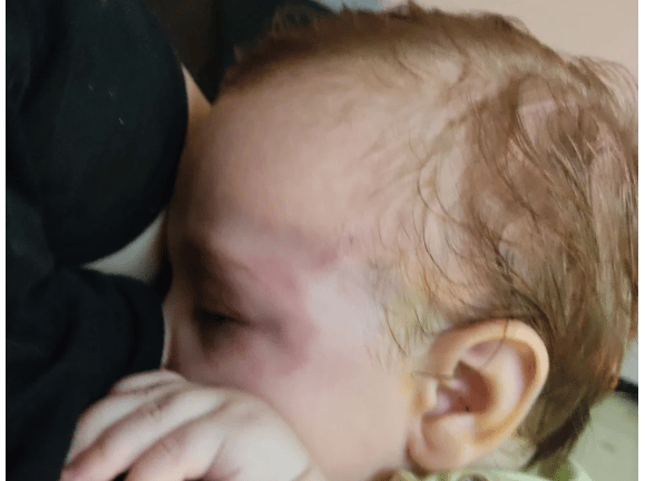 Κρήτη: «Δάγκωνε με μανία το παιδί μου» λέει ο πατέρας του βρέφους δέχθηκε επίθεση από σκύλο