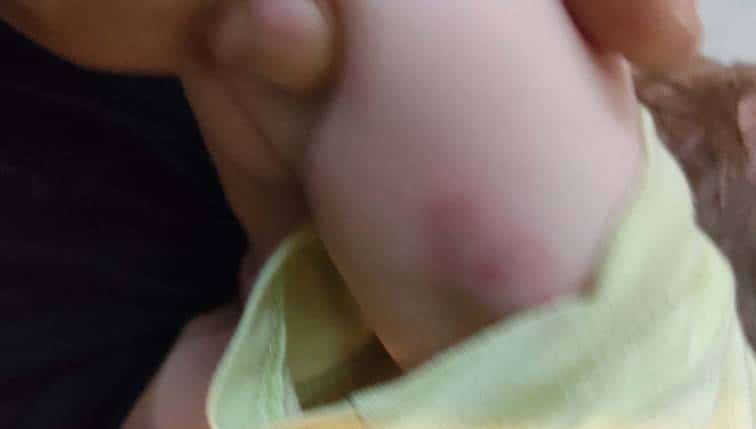 Κρήτη: «Το τράβηξα αλλά σηκώθηκε και γρατζούνισε το μωρό στο κεφάλι» - Τι αναφέρει η ιδιοκτήτρια του λυκόσκυλου