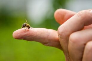 Τι να κάνεις αν σε τσιμπήσει μέλισσα ή σφήκα, χρήσιμες συμβουλές