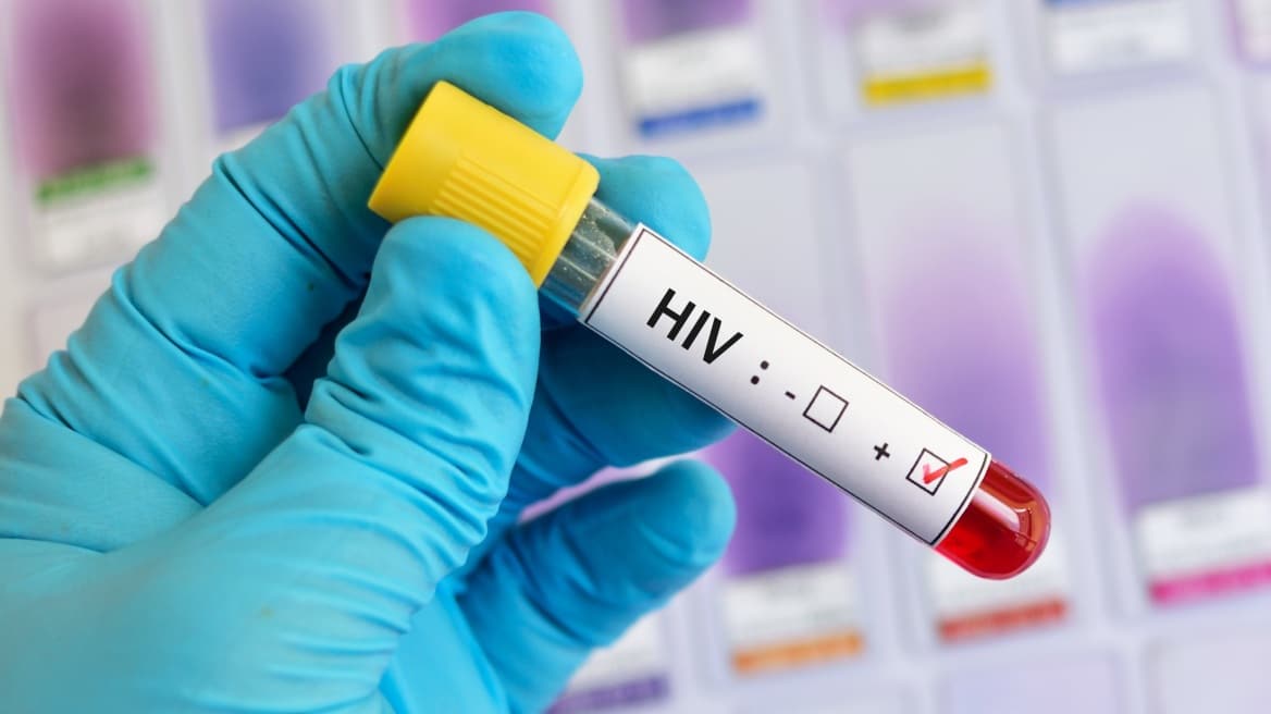 Προφυλακτική αγωγή κατά του HIV πλέον διαθέσιμη και στην Ελλάδα
