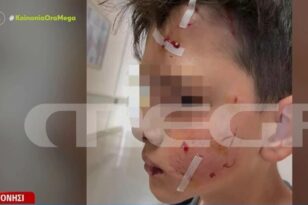 Λαγονήσι - Επίθεση σκύλου σε 14χρονο: Συγκλονίζει η μητέρα του - «Αν δεν ήταν ένας μπαμπάς κοντά, θα τον είχε σκοτώσει» ΒΙΝΤΕΟ