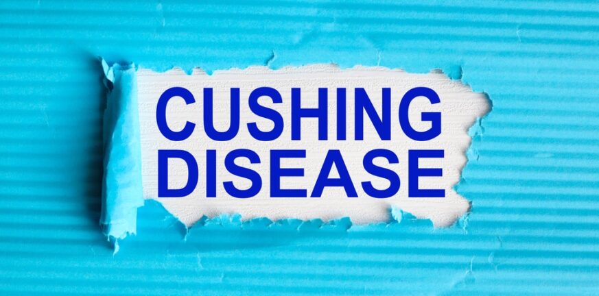 Σύνδρομο Cushing: Πότε ευθύνεται το για τον διαβήτη;