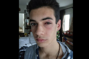 Χαλκιδική: «Έστειλαν» 15χρονο στο νοσοκομείο μετά από ξυλοδαρμό - «Υπερασπιστείτε τα παιδιά σας», λέει η μητέρα του