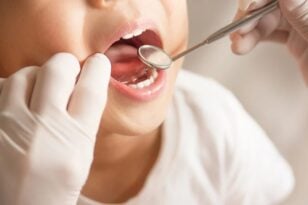 Ξεκίνησε το dentist pass για παιδιά από 6 ως 12 ετών - Πώς γίνονται οι αιτήσεις