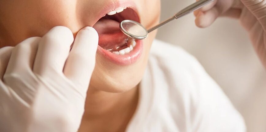 Dentist Pass: Τι αλλάζει με τους δικαιούχους για δωρεάν επισκέψεις στον οδοντίατρο