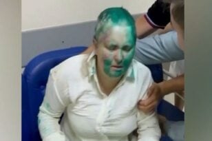Τσετσενία: Δημοσιογράφος δέχτηκε άγρια επίθεση - Της έκοψαν τα δάχτυλα και τα μαλλιά