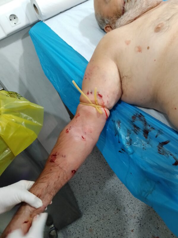 Μεσολόγγι: Στην Πάτρα με τραύματα σε πρόσωπο και σώμα ηλικιωμένος μετά από επίθεση αδέσποτων - ΦΩΤΟ