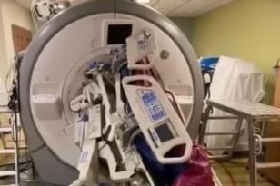 Φρικτό ατύχημα με μαγνητικό τομογράφο στις ΗΠΑ: Ρούφηξε νοσοκόμα και κρεβάτι ασθενή! - ΒΙΝΤΕΟ