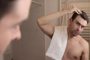 Μύθοι και αλήθειες για τη μεταμόσχευση μαλλιών