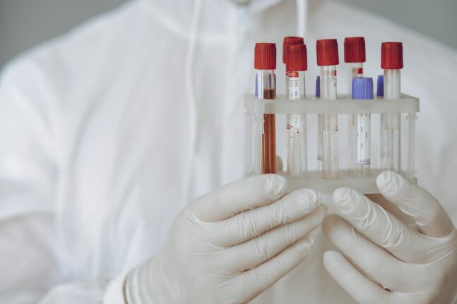 Μια απλή εξέταση αίματος μπορεί να δείξει πόσο γρήγορα γερνάνε το όργανα του σώματος