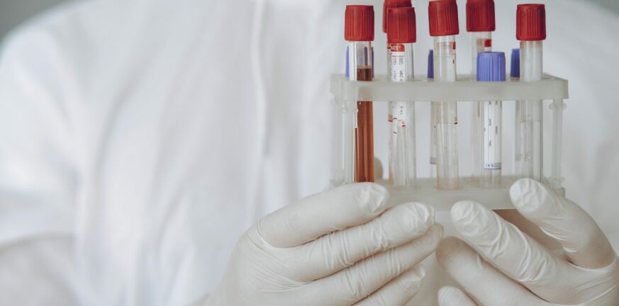 Μια απλή εξέταση αίματος μπορεί να δείξει πόσο γρήγορα γερνάνε το όργανα του σώματος