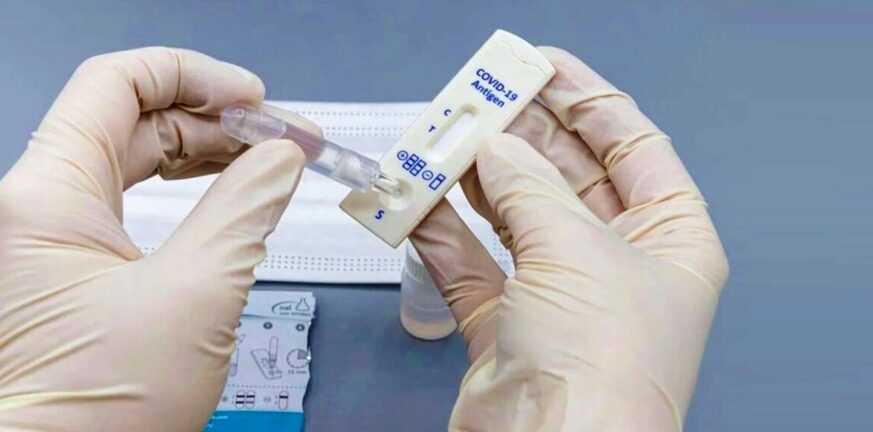 Αχαΐα - Ηλεία: Πού θα γίνονται δωρεάν rapid tests την Τρίτη 16 Απριλίου