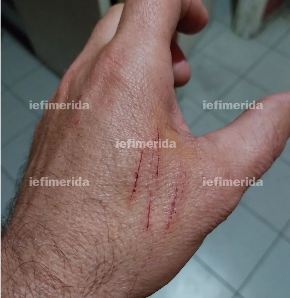 Κορινθία: Ζευγάρι σε διάσταση έβγαλε τα κουζινομάχαιρα και κατέληξαν αμφότεροι με χειροπέδες