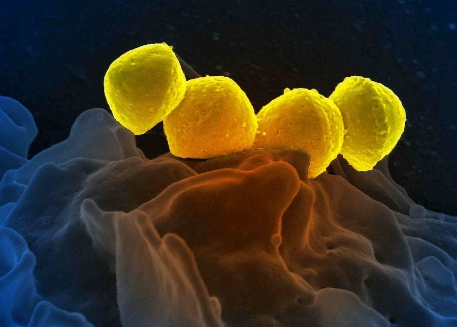 Ηλεκτρονική μικρογραφία σάρωσης βακτηρίων στρεπτόκοκκου ομάδας Α (Streptococcus pyogenes)