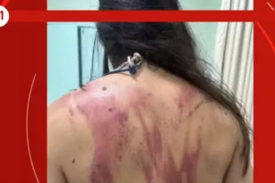 Βραζιλία: Χτύπησε την κόρη του με ματσέτα για το σέρβις αυτοκινήτου!