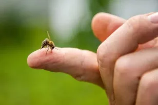 Τι να κάνετε αν σας τσιμπήσει μέλισσα ή σφήκα – Χρήσιμες συμβουλές