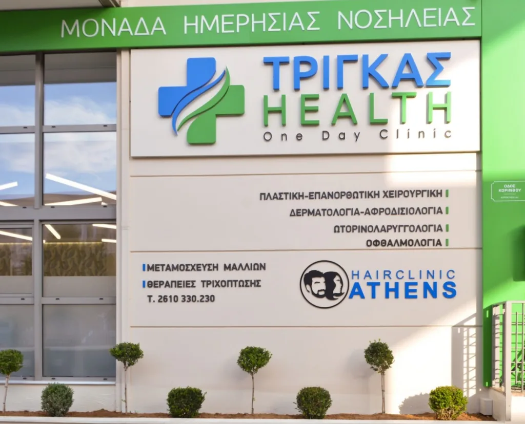 ΤΡΙΓΚΑΣ