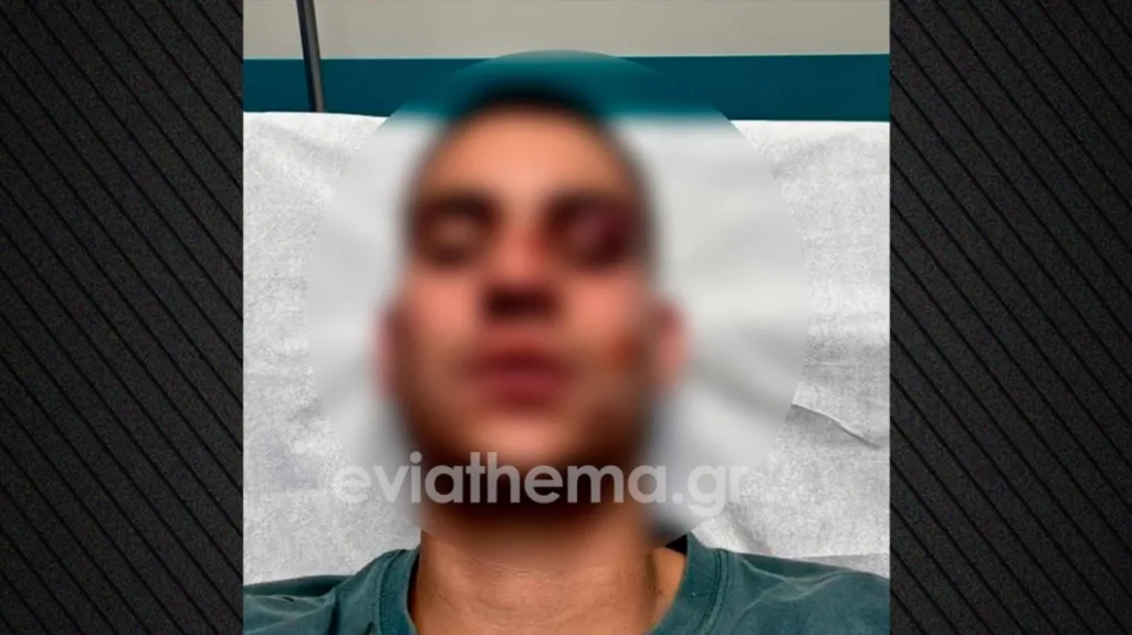 Ξυλοδαρμός για ένα… like: 18χρονος επιτέθηκε βάναυσα σε 19χρονο στη Χαλκίδα – Νοσηλεύεται με σοβαρά τραύματα ΦΩΤΟ