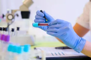 Δωρεάν εξετάσεις: Πότε λήγουν τα ηλεκτρονικά παραπεμπτικά