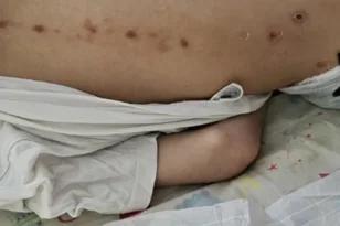 Πάτρα – Έρευνα της Αστυνομίας για κακοποίηση ανήλικου ΑμεΑ: Στην «Π» ο γιατρός που εξέτασε το παιδί