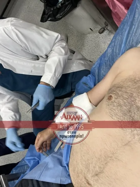 Σκύλος δάγκωσε δικηγόρο! Σοβαρός ο τραυματισμός του στο χέρι ΦΩΤΟ