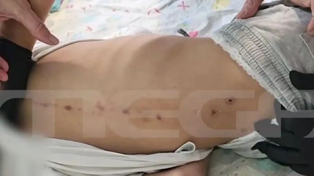 «Το παιδί έχει κακοποιηθεί»! Ξεκάθαρη η θέση για τον 7χρονο ΑμεΑ από την Πάτρα ΒΙΝΤΕΟ, ΦΩΤΟ