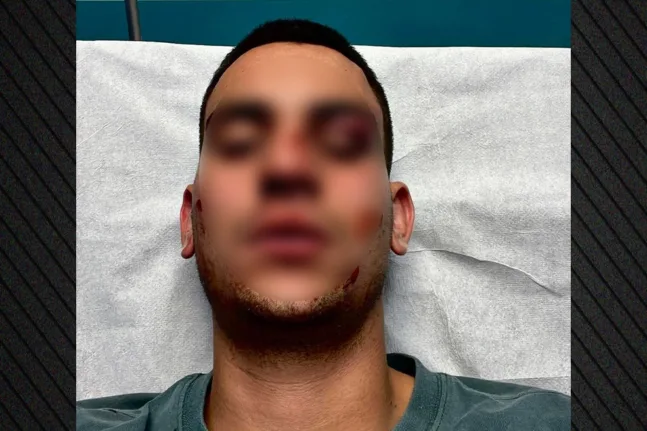 «Τον βρήκα αιμόφυρτο, ήταν σε ημιλιπόθυμη κατάσταση» ο αδελφός του 19χρονου, που έφαγε τρομερό ξύλο για ένα like!