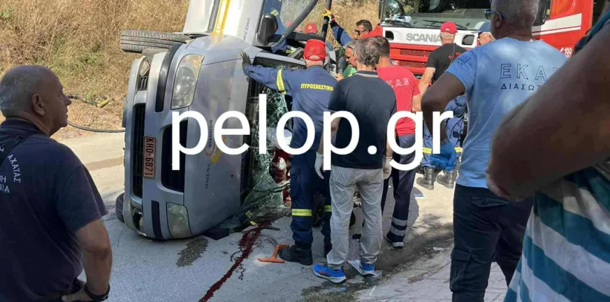 Τροχαίο Κάτω Αχαΐα: Ακρωτηριάστηκαν τρία δάχτυλα της εργαζόμενης του «Βόηθεια στο Σπίτι» Τροχαίο Κάτω Αχαΐα: Ακρωτηριάστηκαν τρία δάχτυλα της εργαζόμενης του «Βόηθεια στο Σπίτι»