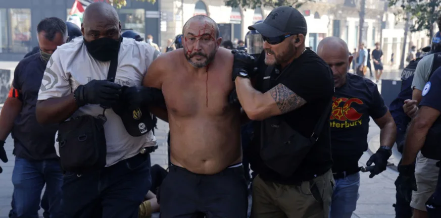 Γαλλία: Ταραχές, πάνω από 175.000 μετείχαν στις διαδηλώσεις, ΦΩΤΟ, ΒΙΝΤΕΟ Γαλλία: Ταραχές, πάνω από 175.000 μετείχαν στις διαδηλώσεις, ΦΩΤΟ, ΒΙΝΤΕΟ
