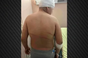 Με αναμορφωτικά μέτρα ελεύθερος ο 18χρονος για τον ξυλοδαρμό του 13χρονου στις Συκιές