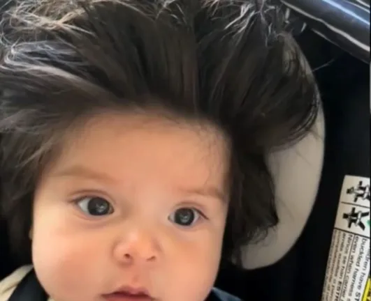 Αυτό είναι το μωρό με τα πιο πυκνά μαλλιά στον κόσμο, ΒΙΝΤΕΟ Αυτό είναι το μωρό με τα πιο πυκνά μαλλιά στον κόσμο, ΒΙΝΤΕΟ