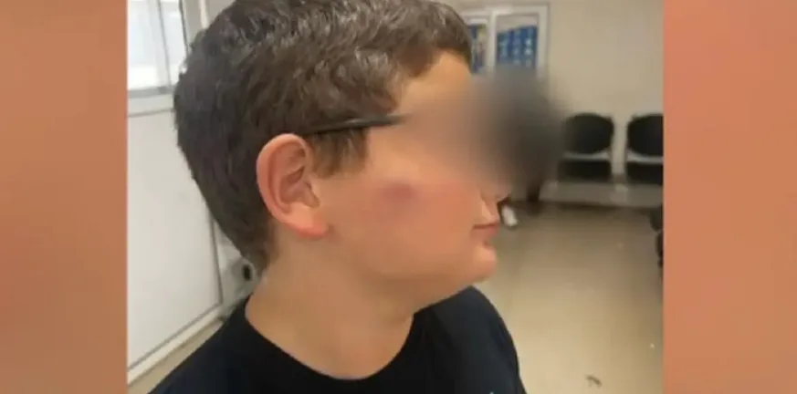 Παλαιόκαστρο: «Μάθετε στον Αλέξανδρο να μην δίνει σημασία» - Σοκάρει η καταγγελία για κακοποίηση 11χρονου σε δημοτικό Παλαιόκαστρο: «Μάθετε στον Αλέξανδρο να μην δίνει σημασία» - Σοκάρει η καταγγελία για κακοποίηση 11χρονου σε δημοτικό