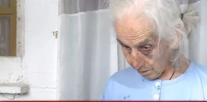 «Τους παρακαλούσα, μη με χτυπάτε άλλο» ληστεία και ξυλοδαρμός γιαγιάς για 100 ευρώ! ΦΩΤΟ