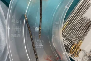 Φοβερό, 13χρονος κατάπιε 100 μαγνήτες! Τους αφαίρεσαν οι γιατροί στη Ν. Ζηλανδία, ΦΩΤΟ