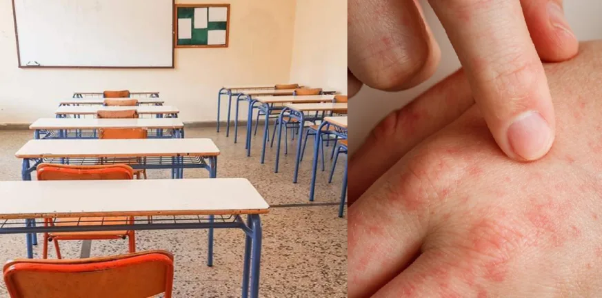 Θεσσαλονίκη: Κρούσματα ψώρας σε Γυμνάσιο της Τούμπας, τι ισχύει για το σχολείο Θεσσαλονίκη: Κρούσματα ψώρας σε Γυμνάσιο της Τούμπας, τι ισχύει για το σχολείο