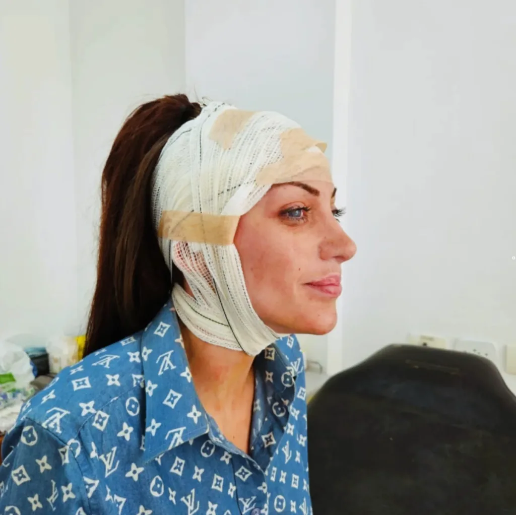 Νεκρή η influencer «Barbie» της Βραζιλίας με τις 27 εγχειρήσεις, ΦΩΤΟ Νεκρή η influencer «Barbie» της Βραζιλίας με τις 27 εγχειρήσεις, ΦΩΤΟ