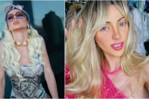 Νεκρή η influencer «Barbie» της Βραζιλίας με τις 27 εγχειρήσεις, ΦΩΤΟ