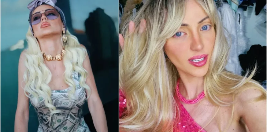 Νεκρή η influencer «Barbie» της Βραζιλίας με τις 27 εγχειρήσεις, ΦΩΤΟ