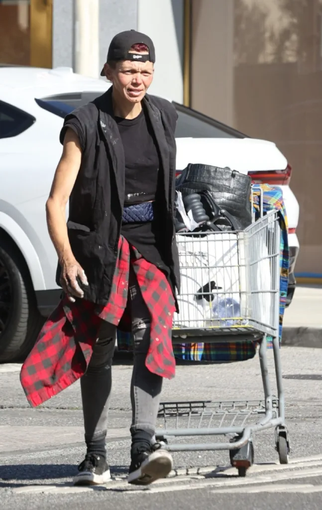 Από διάσημο μοντέλο, η άλλοτε καλλονή Λόνι Γουίλισον, με μεγάλη περιουσία, άστεγη στους δρόμους να τρώει από τα σκουπίδια Από διάσημο μοντέλο, η άλλοτε καλλονή Λόνι Γουίλισον, με μεγάλη περιουσία, άστεγη στους δρόμους να τρώει από τα σκουπίδια