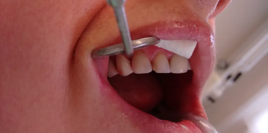 Σφραγίσματα: Η απαγορευμένη επικίνδυνη ουσία, τι ισχύει στην Ευρώπη και άλλες χώρες